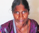 Udupi: Prasad Netralaya Surgeons perform Rare Surgery on Eye of Woman