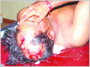 Moral Policing : Youth brutally assaulted in Ullal