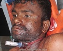 Mangalore: Chennai Couple Attempts Suicide - Man Critical