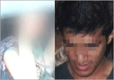 Mumbai: Girl forced to drink acid by ex-boyfriend, critical