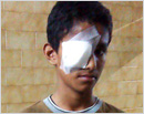 Mangalore: Boy injured as science experiment backfires
